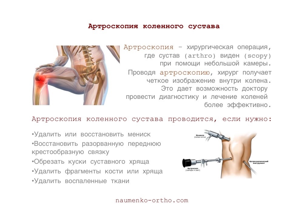 После приседаний боли в тазобедренном суставе После приседаний боли в тазобедренном суставе