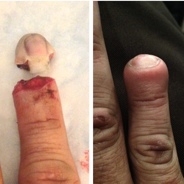 bad girls blog adult chronic vaginal bacterial infection