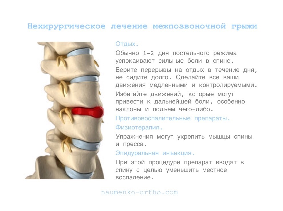 Болезнь позвоночника французского бульдога Болезнь позвоночника французского бульдога