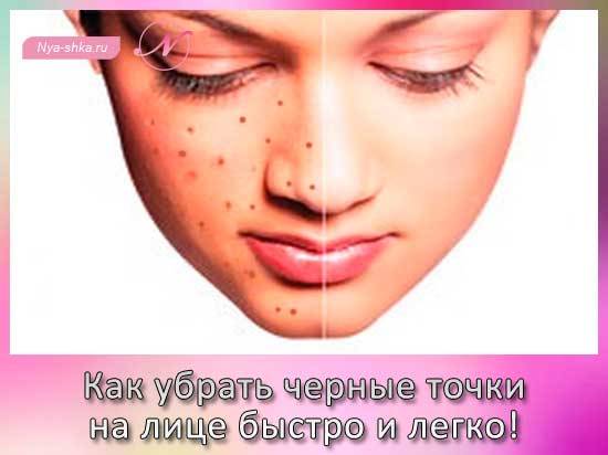 С чем убрать черные точки с лица в домашних условиях
