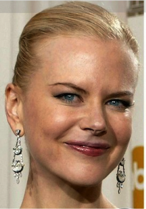 Natural Botox Effect For Eyes Natural Botox Effect For Eyes