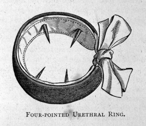 Four-pointed urethral ring for the treatment of masturbation. +