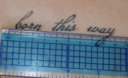 Tags: tattoo tattoo removal laser tattoo removal