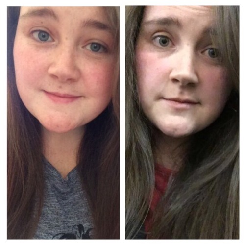 my nose looks bigger as i lose more weight | Tumblr