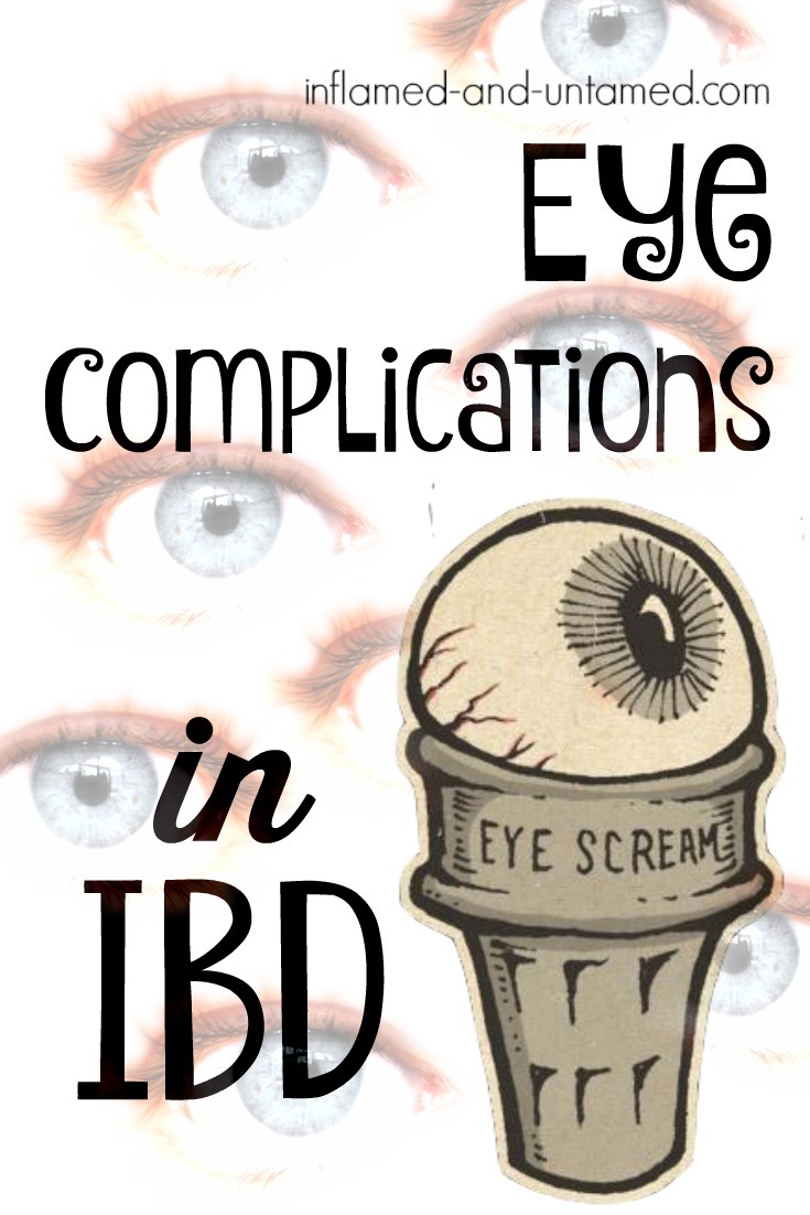 Eye Complications in Crohn’s Disease and... Inflamed and Untamed