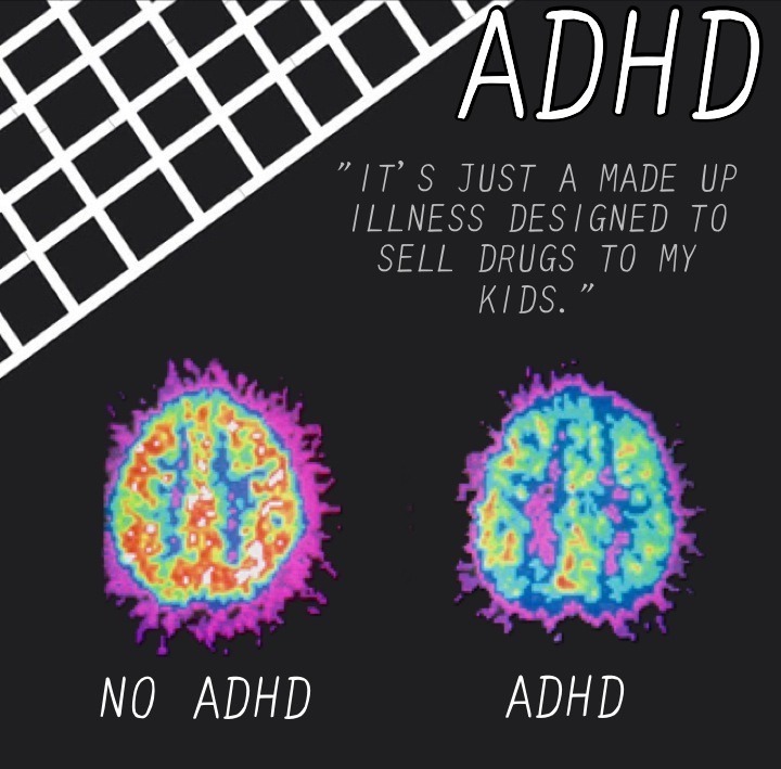innocentpunkrockkids:
“ “The brain can get sick too."
Re-make of this post.
End mental health stigma.
”
Everyone should reblog
