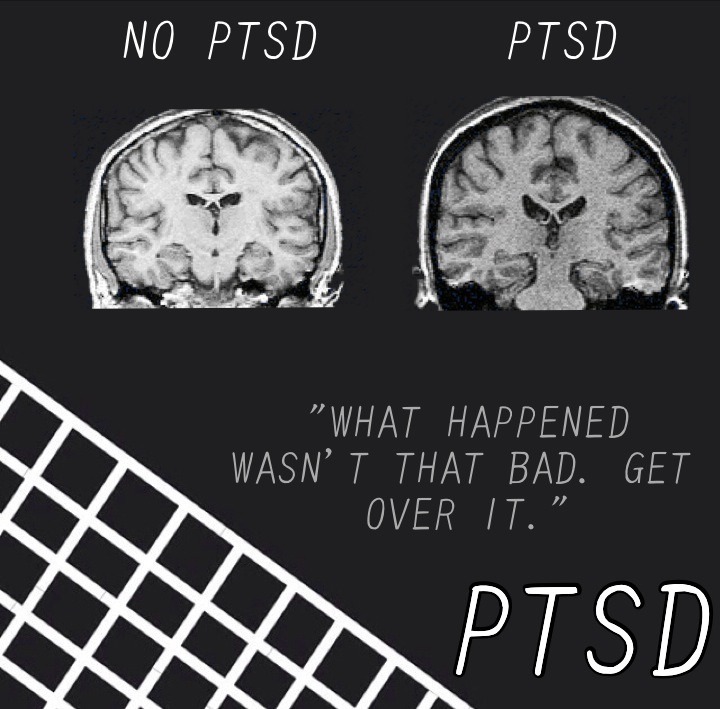 innocentpunkrockkids:
“ “The brain can get sick too."
Re-make of this post.
End mental health stigma.
”
Everyone should reblog