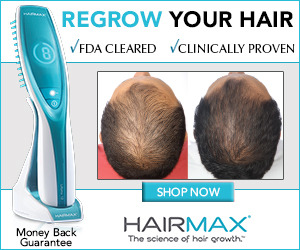 Hair Regrowth For Men Provillus Groei360