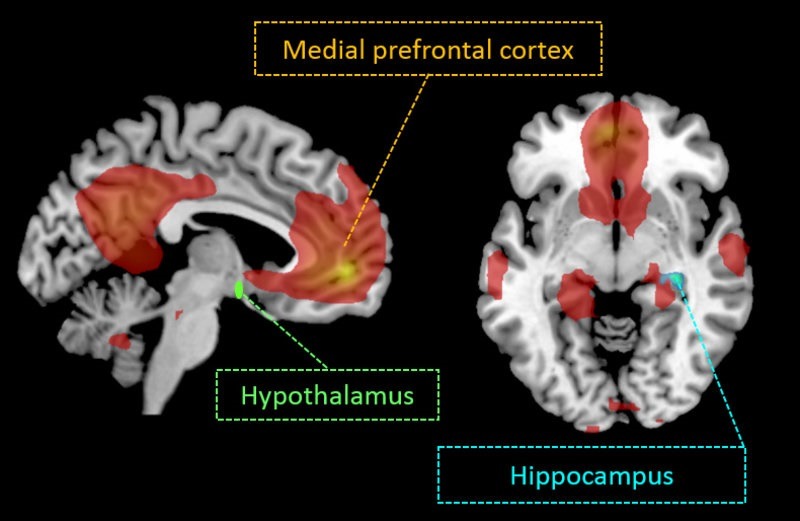 Navigator Neurons Play Critical Role In Sense Of Smell >> Neuroscience How Insulin In The Brain May Suppress The Navigator Neurons Play Critical Role In Sense Of Smell >> Neuroscience How Insulin In The Brain May Suppress The