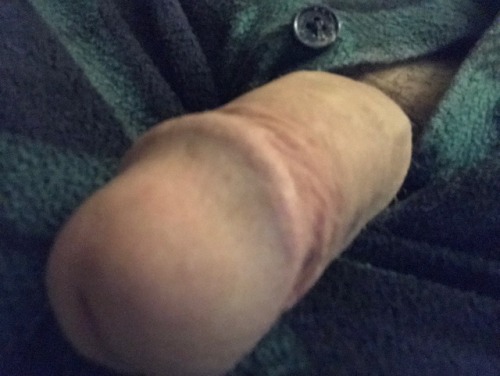 Playing with my fatty penis.