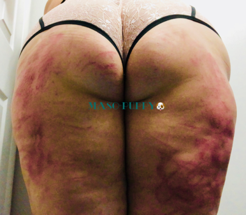 thechronicmasochist:maso-puppy:My ass looks terrible but my...