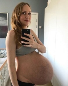 @pregnant/dl