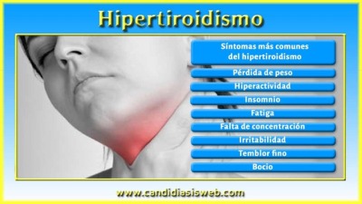 Resultado de imagen de hipotiroidismo