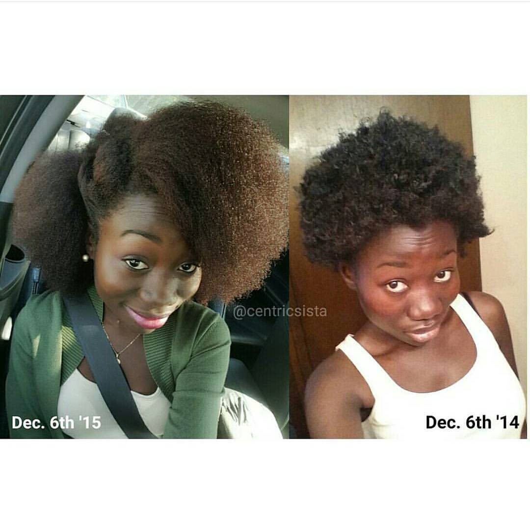 Tobnatural Congrats To Centricsista On One Year Natural