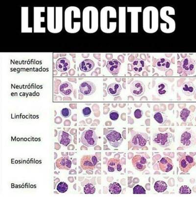 que pasa si los neutrofilos segmentados estan altos que pasa si los neutrofilos segmentados estan altos