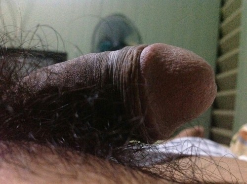 Hairy hairy