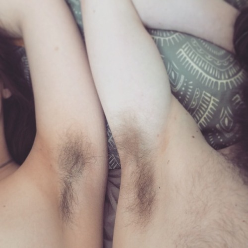 Hairy Women