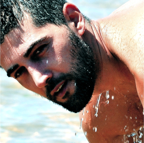 Hairy chest, legs,Beard and Mustache.