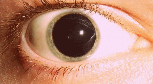blown pupil acid