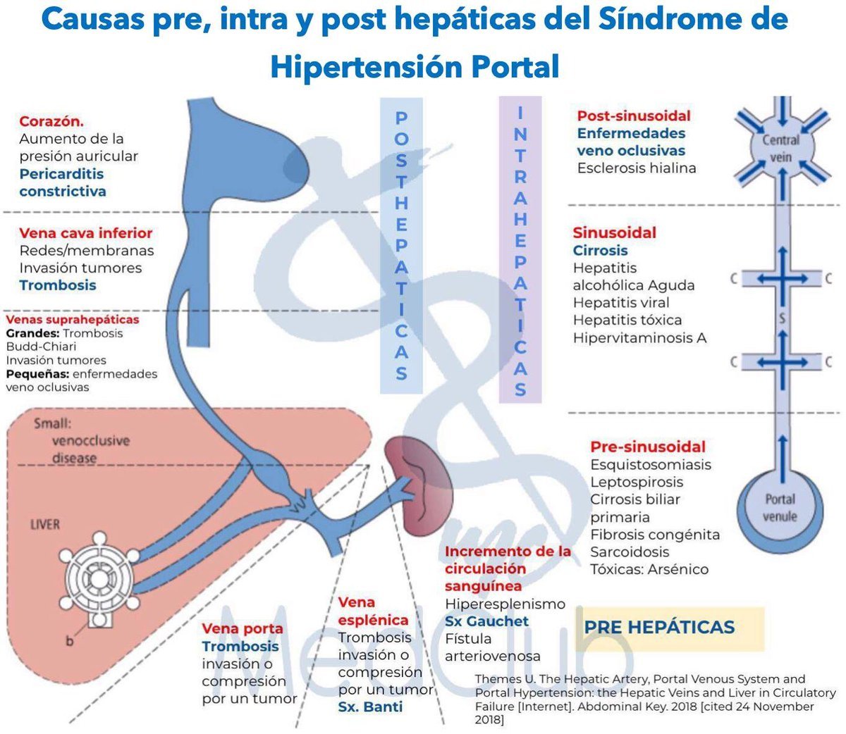 Trombosis de la vena porta prehepática