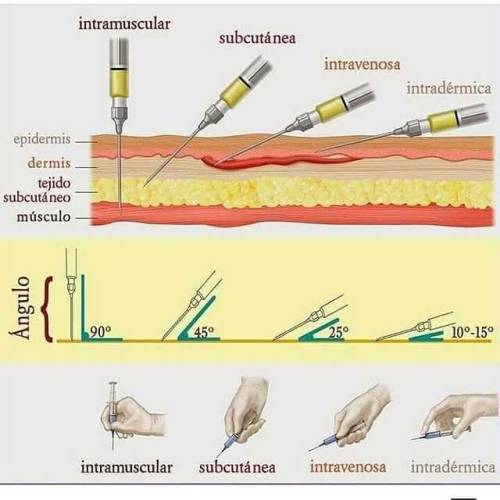 un-cerebro-hambriento:Vías de administración inyectable.