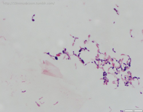 MICROCOSM | Corynebacterium macginleyi eye infection