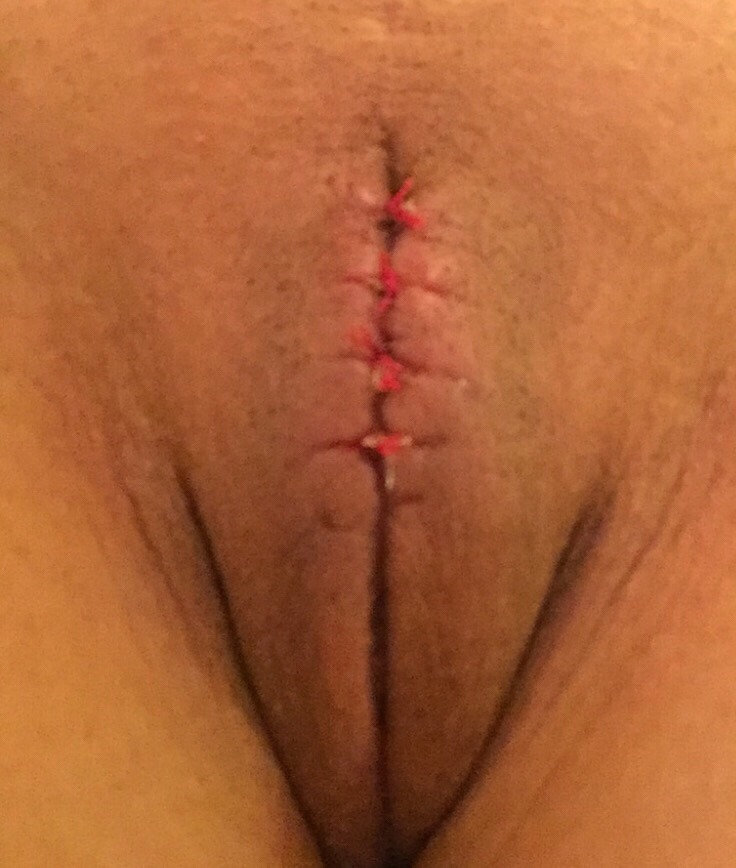 Pussy sewn up 💖 Femdom Male Genital Mutilation Pics - Heip-l