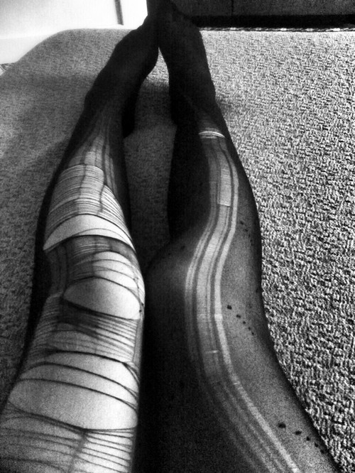 Ripped Tights On Tumblr