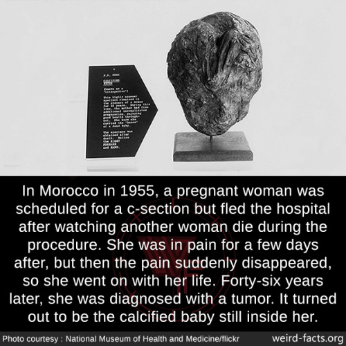 mindblowingfactz