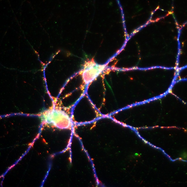 Mediamed Neurones Fluorescents Fluorescent Neurons Credit