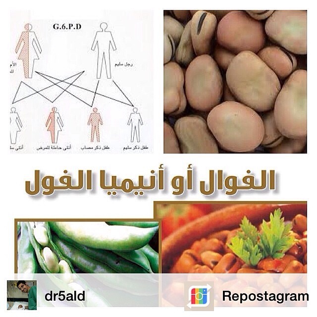 توب دكتورز Dr5ald الفوال Favism أنيميا الفول هو فقر دم