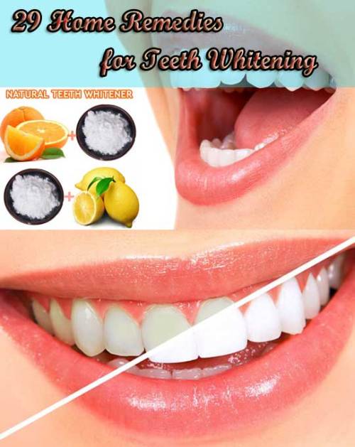 Home Remedies Store • 29 Home Remedies for Teeth Whitening