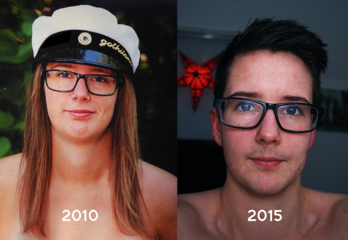 trans transgender transsexual dfab afab FtM transition pre-T me comparison