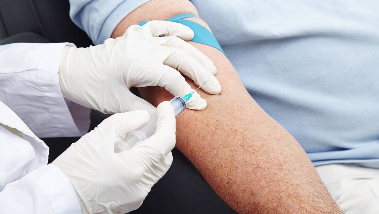 números de PSA después de la cirugía de cáncer de próstata