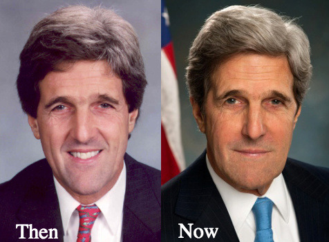 free john kerry plastic surgery