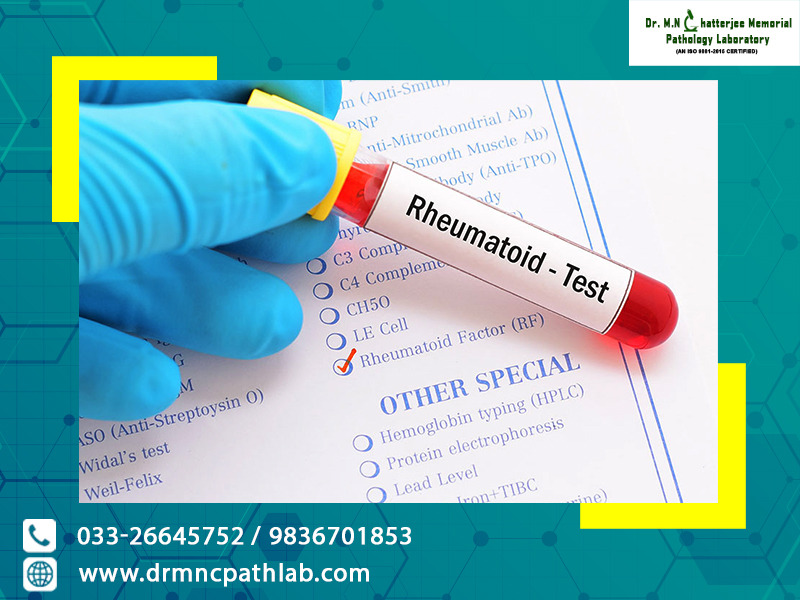 how to read rheumatoid arthritis blood test