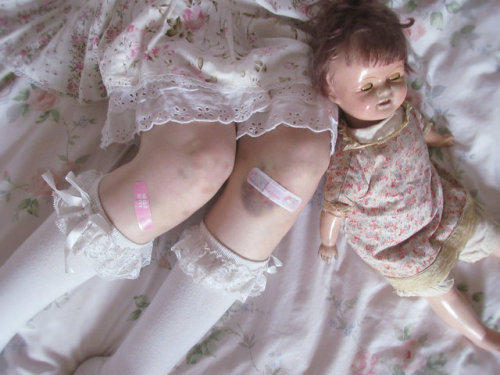 susie bruise doll