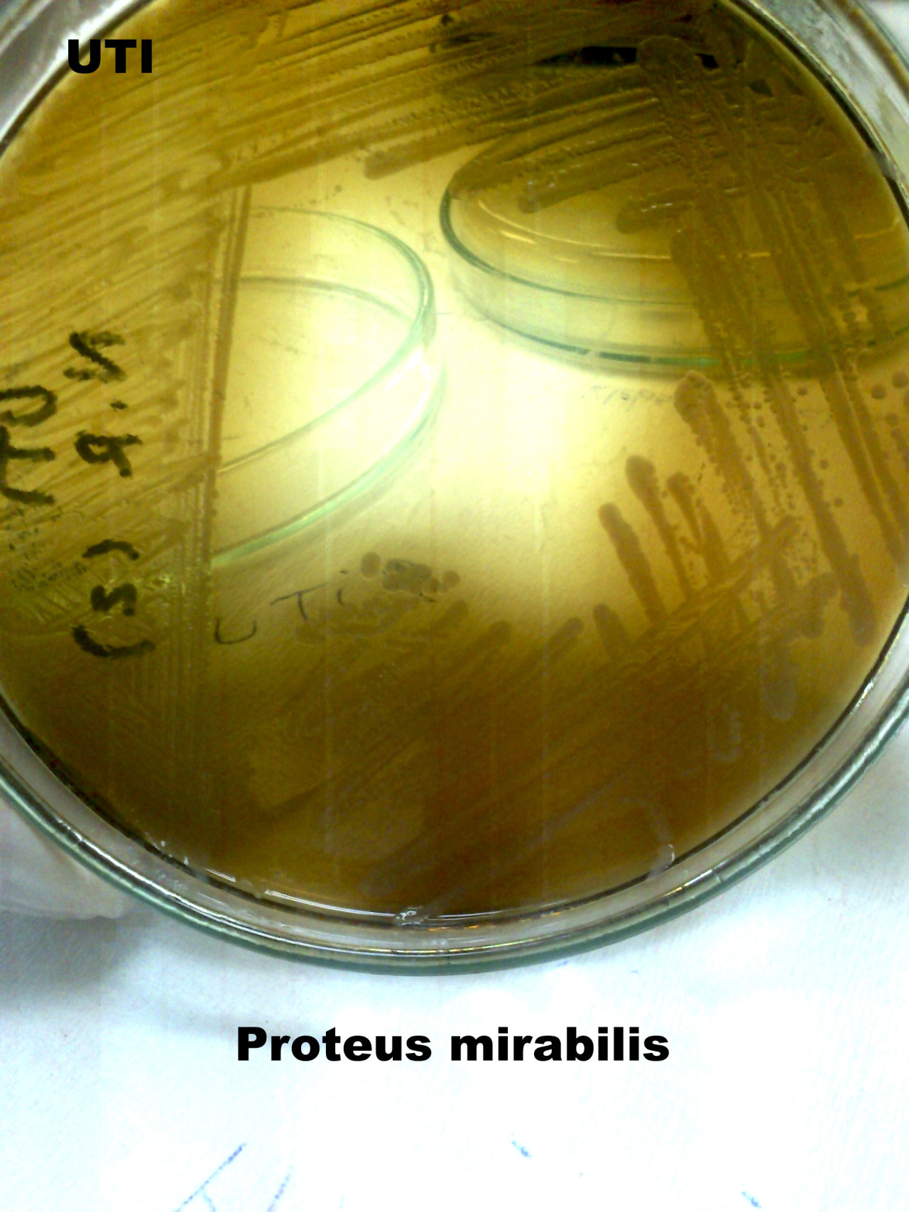 Proteus Mirabilis On Blood Agar