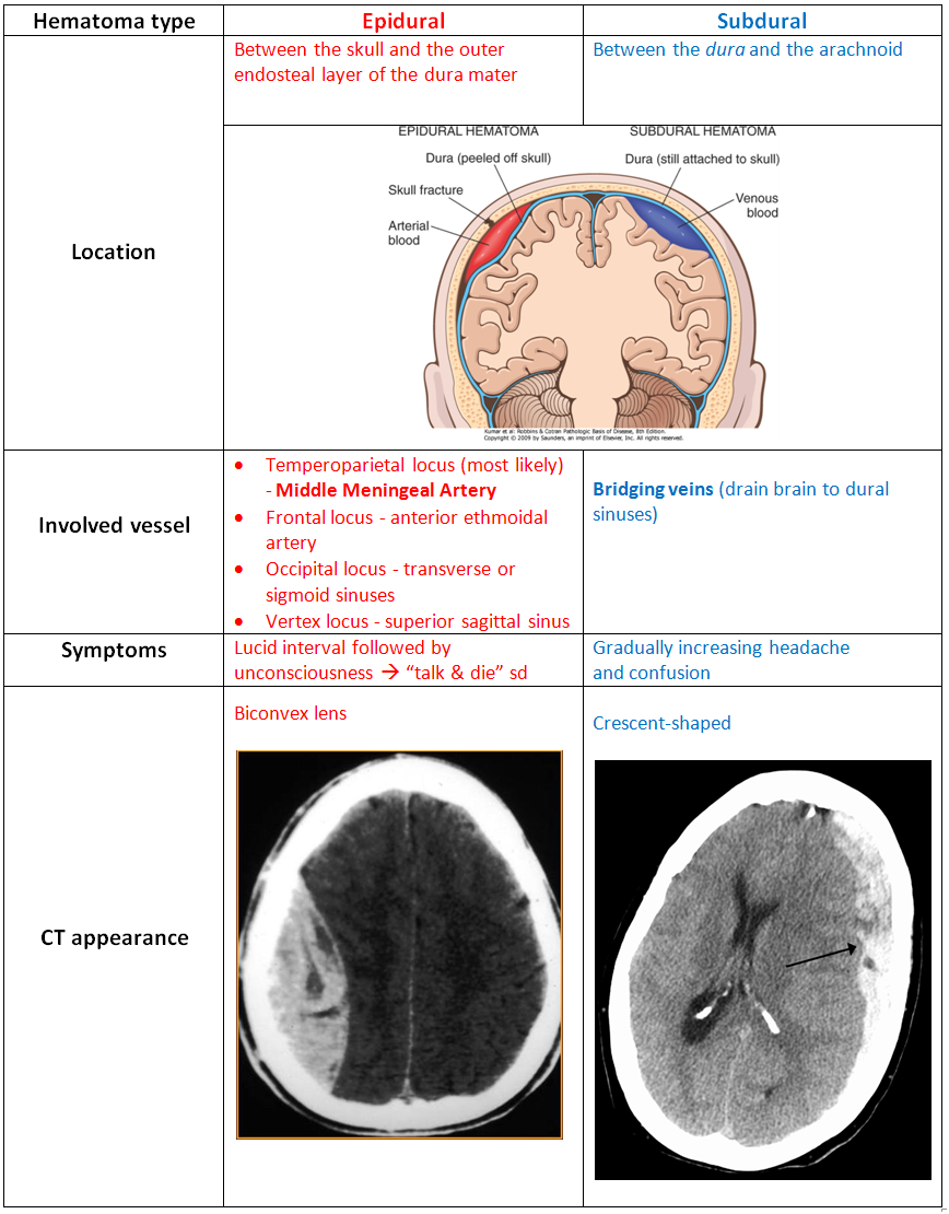 my-notes-for-usmle-epidural-subdural-hematoma