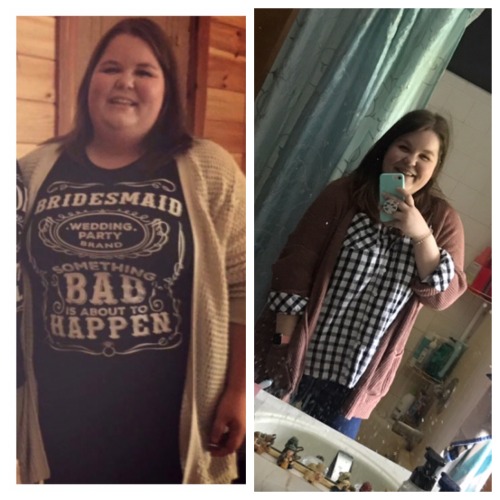 Before and After Weight Loss Pictures