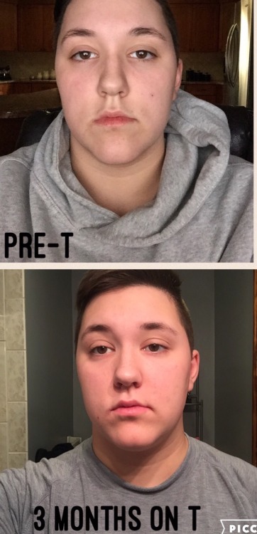 I’m 3 months on T as of Saturday. I’ve had lots of changes this...