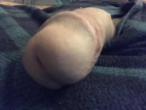 Playing with my fatty penis.