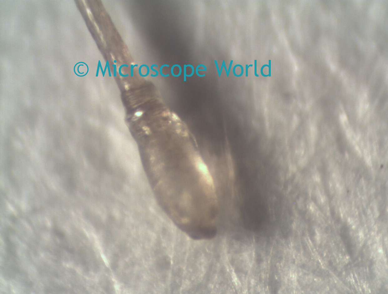 Hair Root Under Microscope - Micropedia