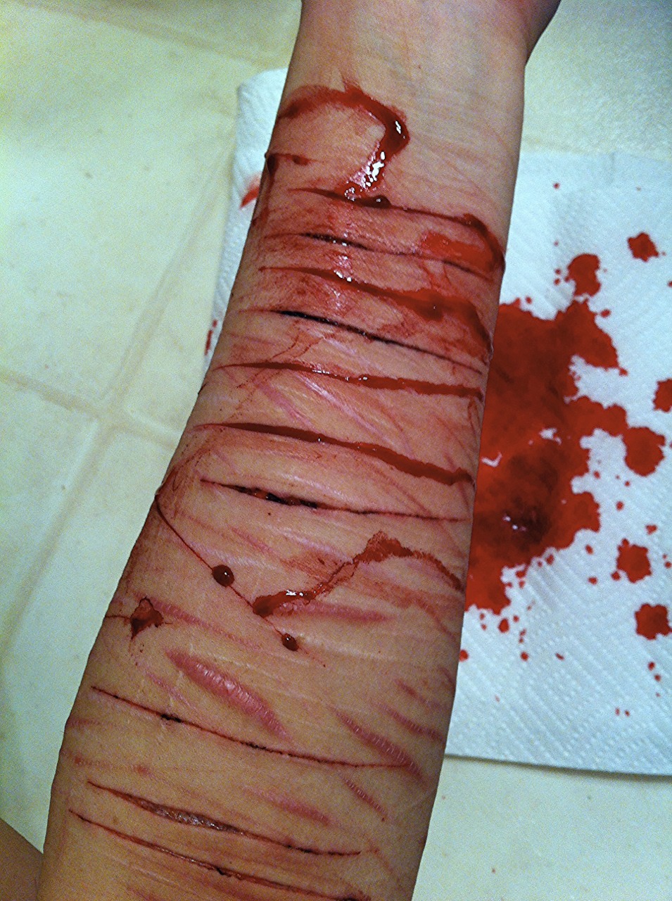 <b>Self</b> <b>Harm</b> Cuts On Legs Tumblr - ma.