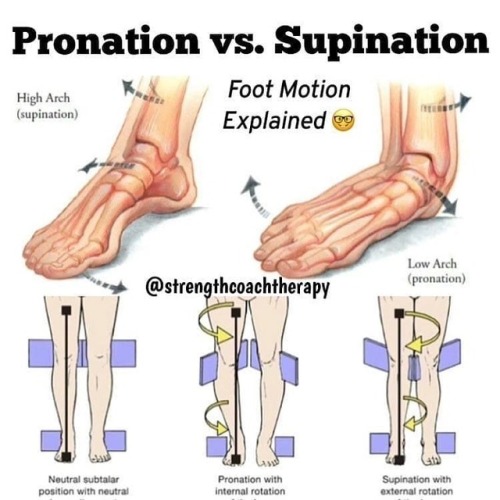 over supination shoes
