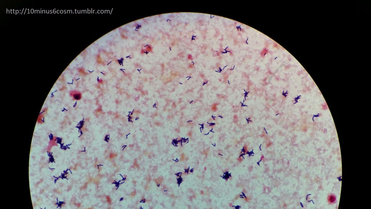 MICROCOSM | Arcanobacterium haemolyticum: An under-recognized...