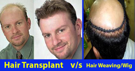 Hair Wig Tumblr