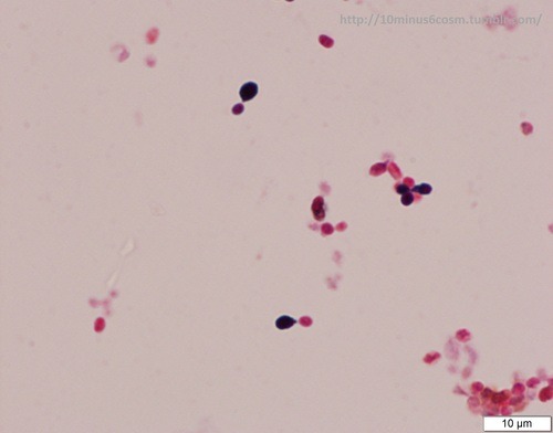 MICROCOSM | Histoplasma capsulatum taking its time to grow