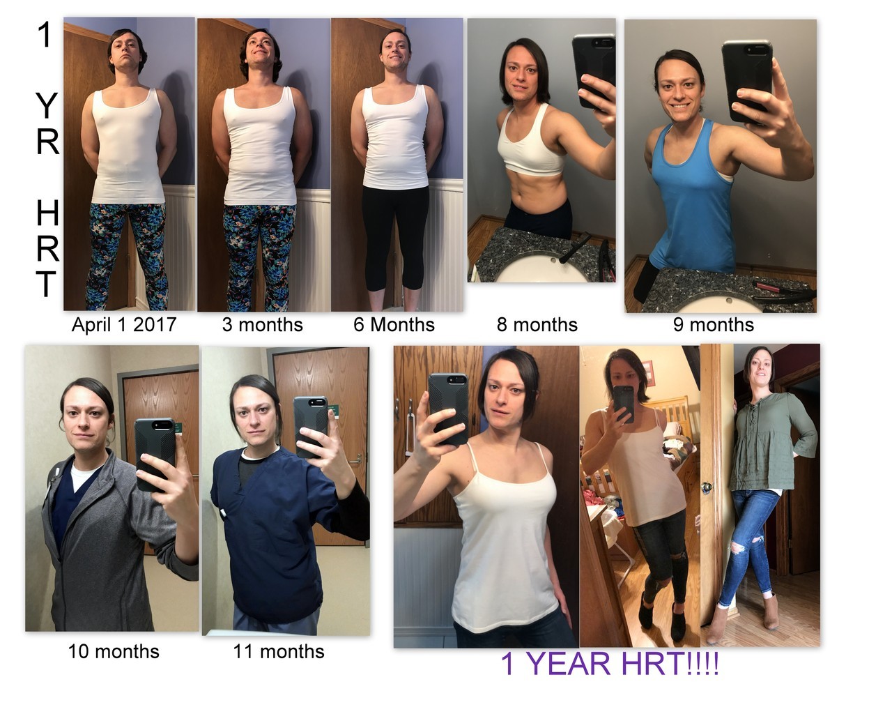 Authentic Erica — One Full Year On Hrt I Cannot Believe It Has