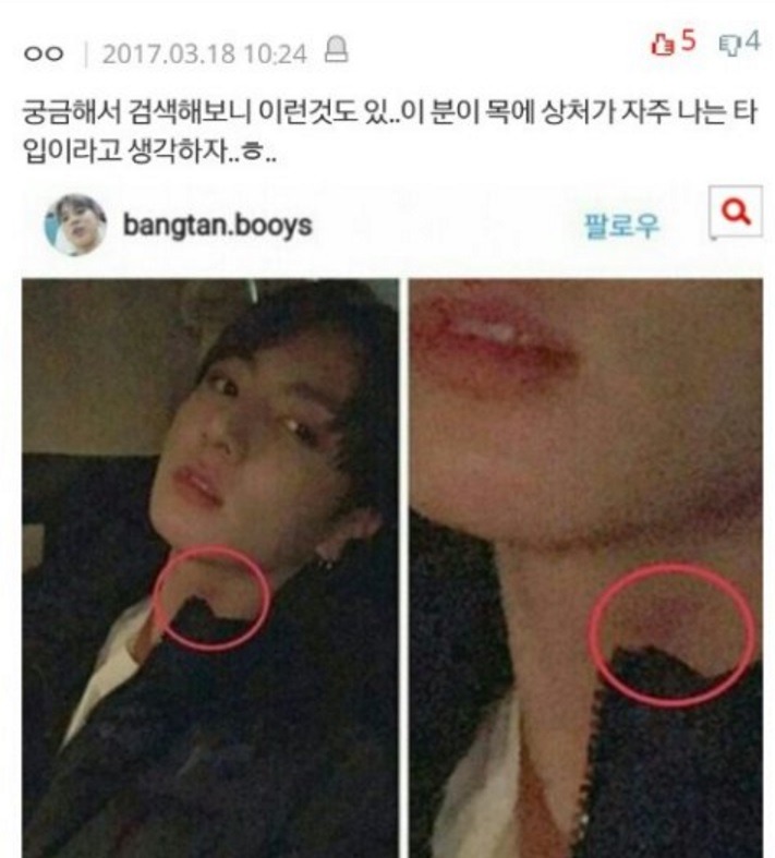 Knetizens Say They Found a Brand New “Hickey” on Jungkook’s Neck, and